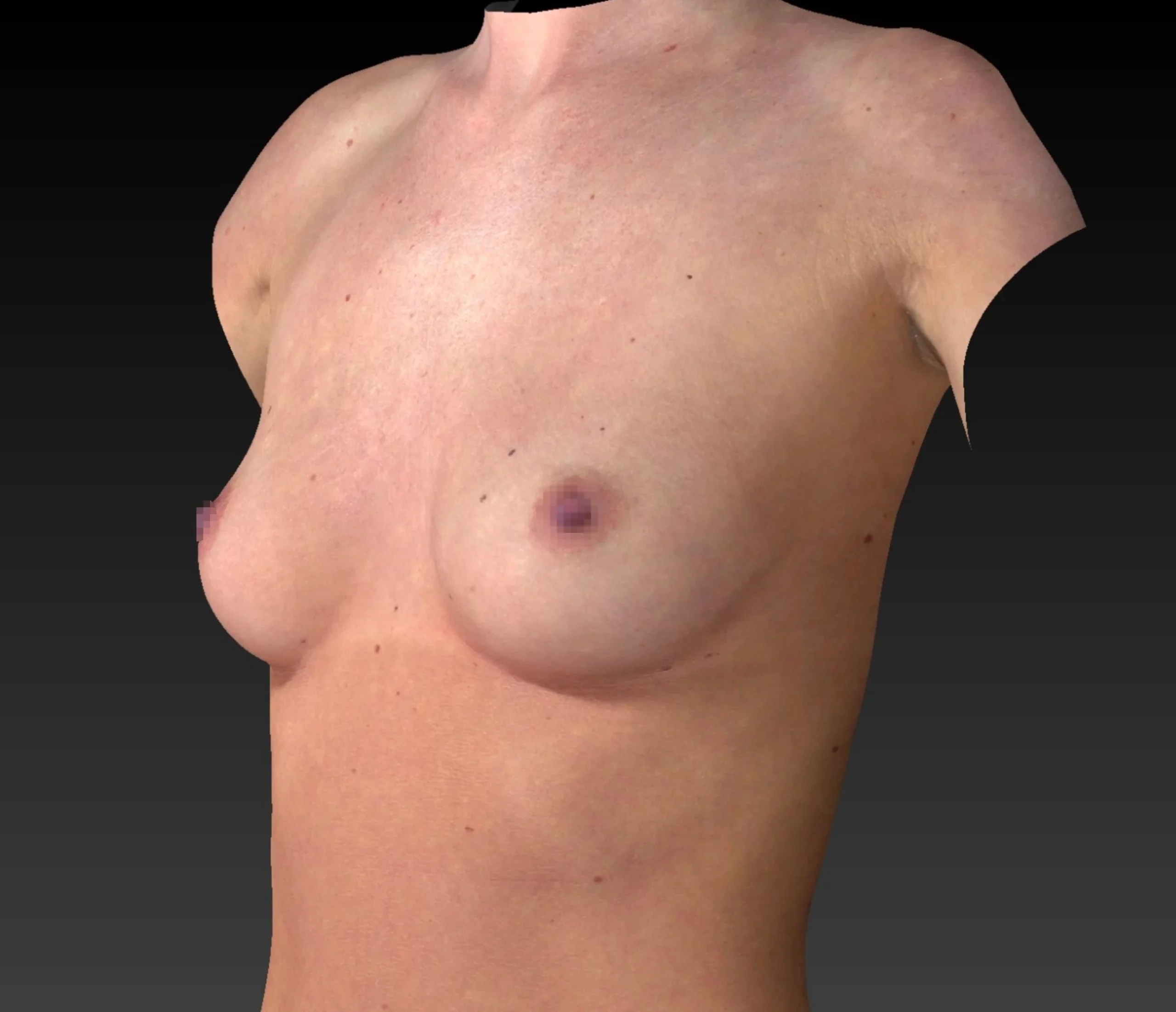 Brustgröße A anatomisch