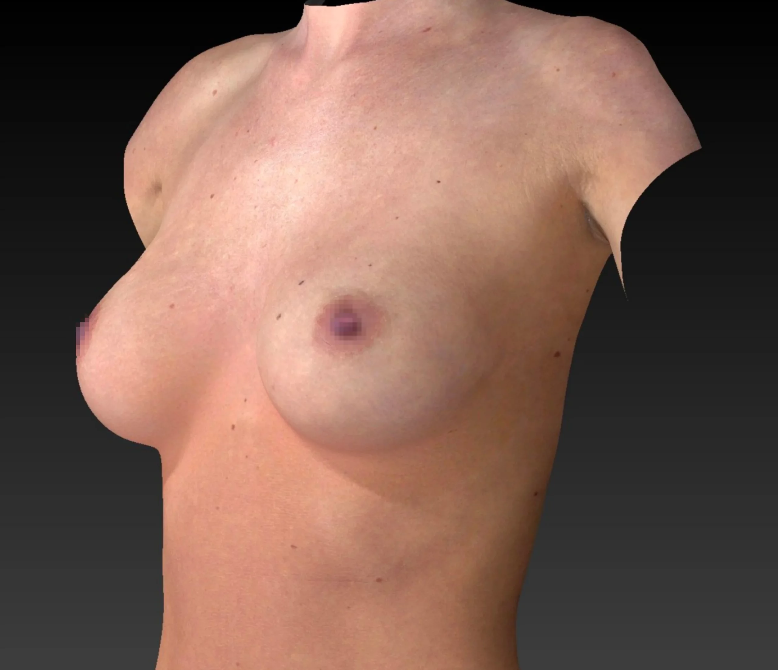 Brustgröße B anatomisch