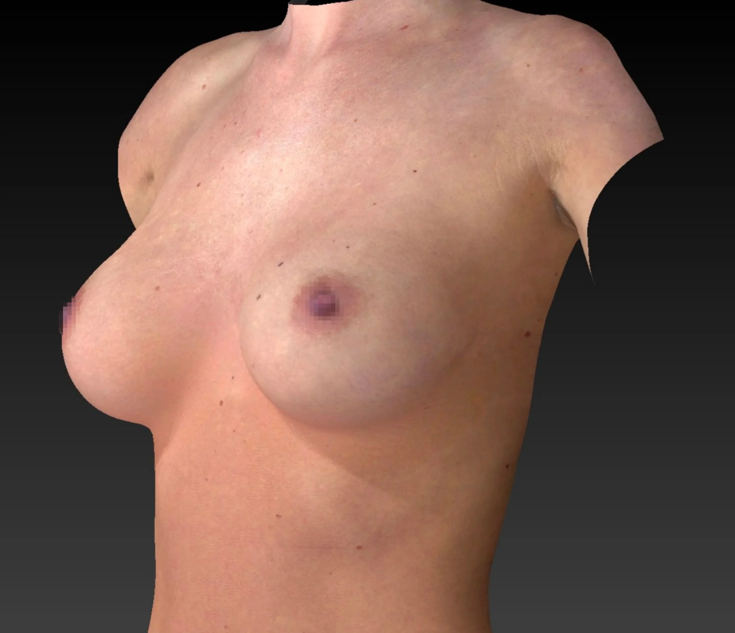 Brustgröße C anatomisch