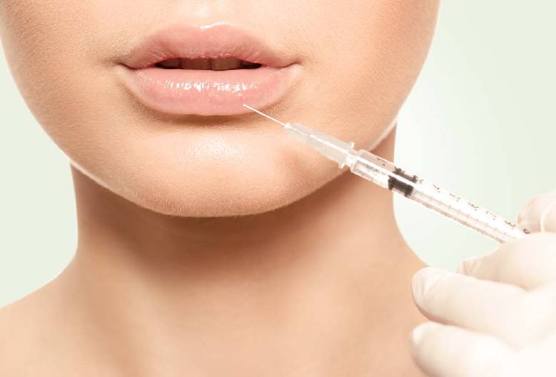 Natürliche Lippenkorrektur mit Hyaluron für mehr Volumen