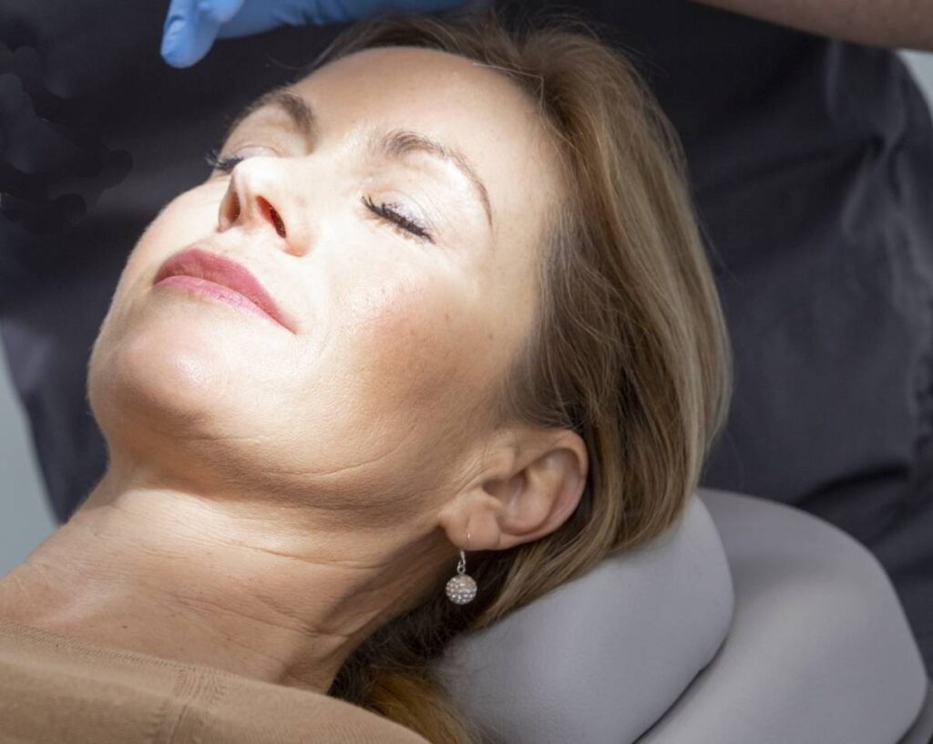 Patientin nach Gewichtsabnahme mit sichtbarem Volumenverlust im Gesicht.